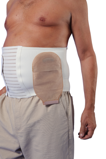 Thuasne, Abdominalni oporni pas za bolnike s stomo Stomex